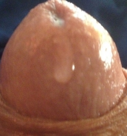 Kunnen jullie me Prostaatje doen ? Video ook voor jullie