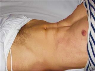 Knap geval wil prostaatje electrisch laten behandelen.mag op video.