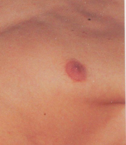 ik zoek oudere hobby masseur. Omg Bollenstreek Amstelveen Leiden Haarl