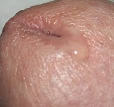 zijn jullie met zn twee-en ? Roken jullie ook blowtje ?