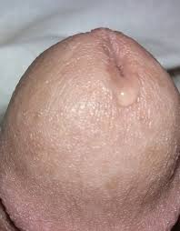 tenger haarloos lijfje ligt bloot voor uw kijk & foto-hobby en voo